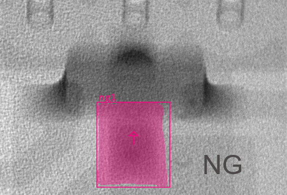 NG: Defective solder joint Automated AI inspection marking a defective BGA solder joint as 'NG' (No Good) during X-ray analysis to prevent PCB field failures.
